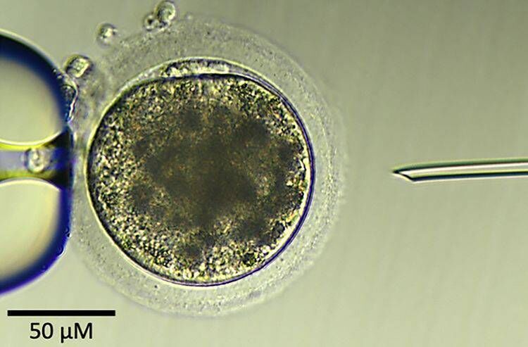 A donkey egg immediately before an intracytoplasmic sperm injection. Picture: Andres Gambini