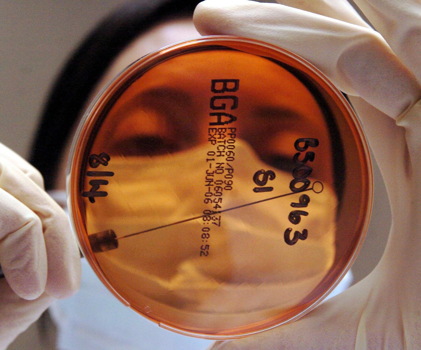 Scientists take first steps towards urine test for cancer