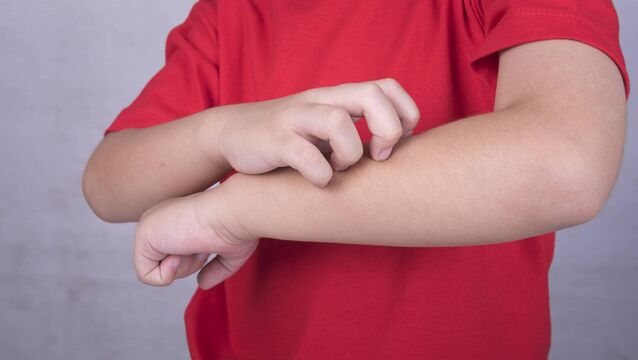 <p>My three-year-old son has mild eczema, which comes and goes</p>