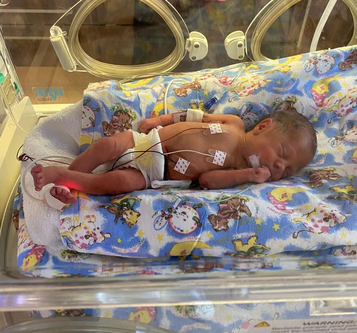 Lauren McCarthy was born nine weeks early, weighing just 3lb. Lauren McCarthy was born nine weeks early, weighing just 3lb.