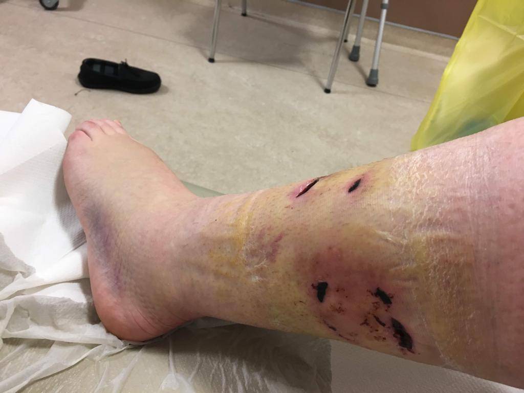 New working group to tackle 'devastating' dog attacks