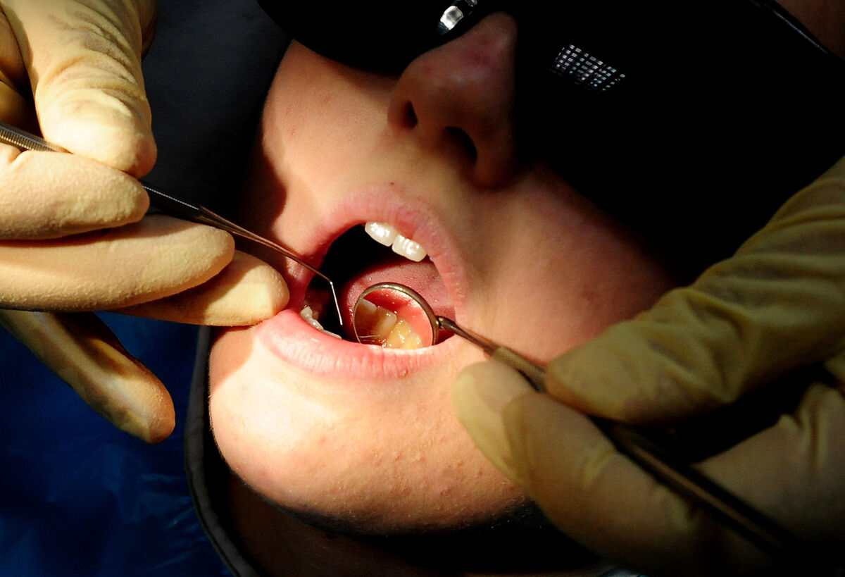 There are currently two-year waiting lists for treatments requiring General Anaesthetic with dentists saying that they are being forced to choose which children they believe are suffering the most pain and treat them ahead of patients who may have already been waiting months or years. File photo There are currently two-year waiting lists for treatments requiring General Anaesthetic with dentists saying that they are being forced to choose which children they believe are suffering the most pain and treat them ahead of patients who may have already been waiting months or years. File photo