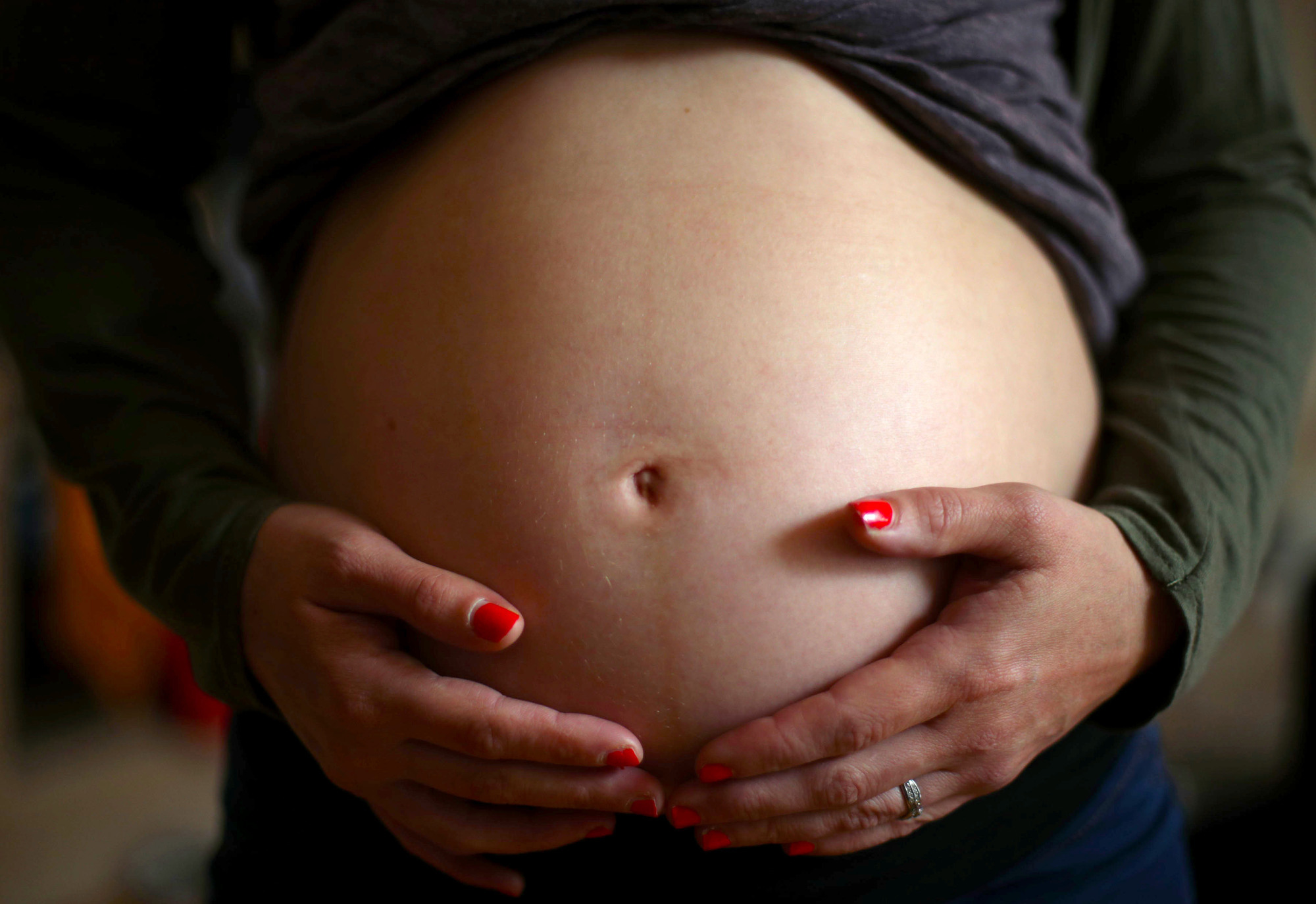 Extra pregnancy scan could slash number of breech births and risk to babies