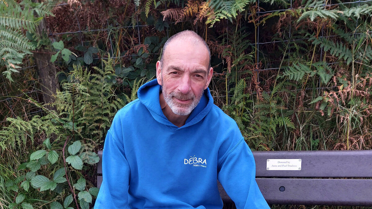 Cancer survivor trains for Kerry mountain trek in aid of 'butterfly skin' charity - Vimarsana News