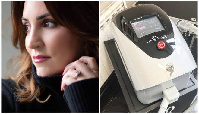 Simone Gannon: I had laser tattoo removal on my eyebrows - here's how I got on