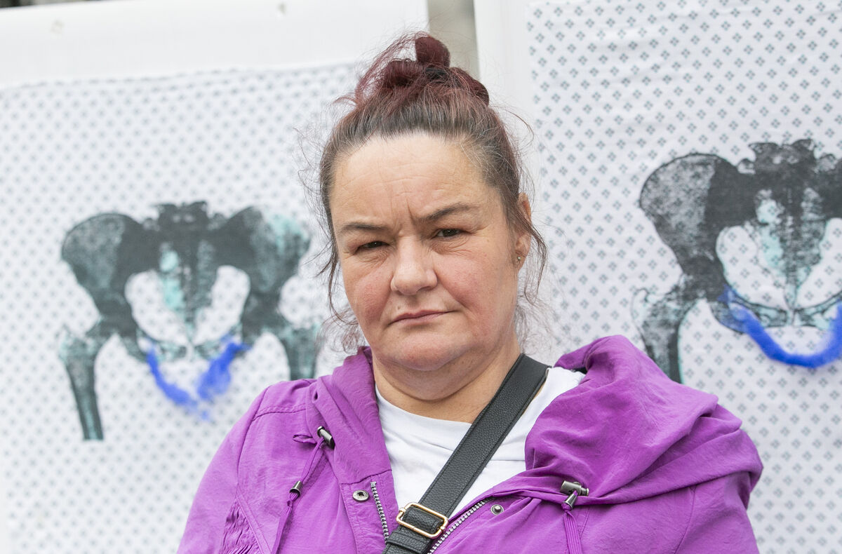 Terri Martin: 'I am on antibiotics continuously'. Picture: Gareth Chaney/ Collins Photos Terri Martin: 'I am on antibiotics continuously'. Picture: Gareth Chaney/ Collins Photos