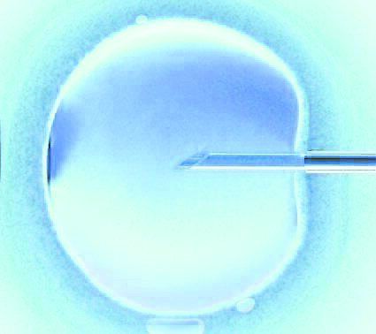 Many factors, including the quality of embryos, can influence the likelihood of success in IVF.