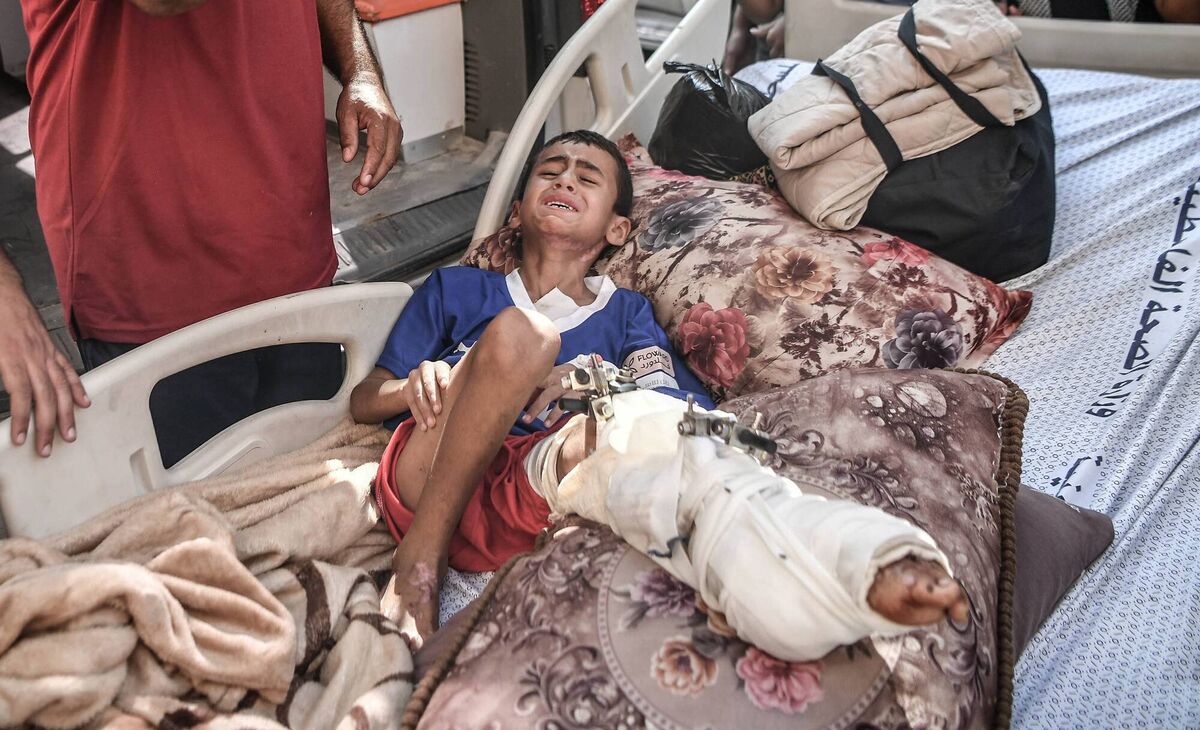 A child cries in pain, lying on a stretcher at Nasser Hospital, as people carry severely wounded Palestinians to ambulances to be transferred to Egypt for treatment in Khan Yunis, Gaza on November 01, 2023. (Photo by Abed Zagout/Anadolu via Getty Images)