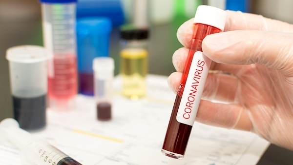 GPs to get personal protection packs for coronavirus from HSE