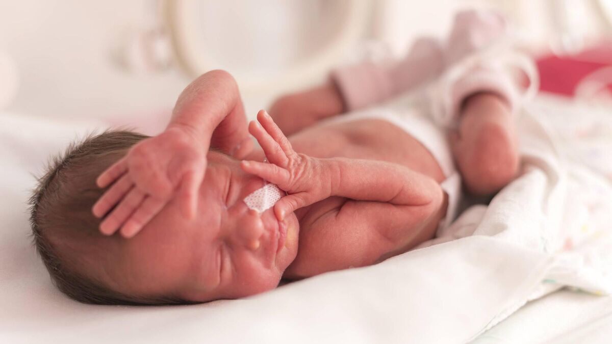 Delayed cord clamping could reduce risk of premature infant death by 66% - Vimarsana News