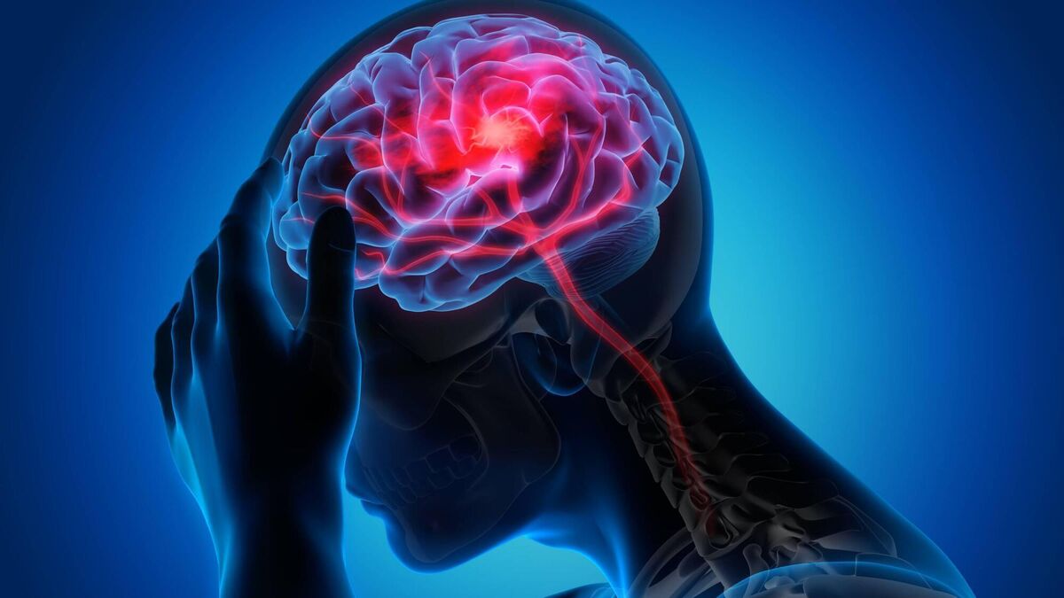 Stroke patients abandoned after hospital treatment, Oireachtas hears - Vimarsana News