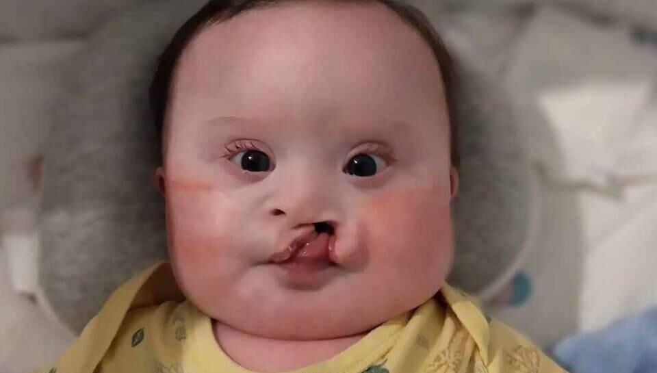 Little Warior: On more than one occasion, Nickey has proved his doctors and specialists wrong Little Warior: On more than one occasion, Nickey has proved his doctors and specialists wrong