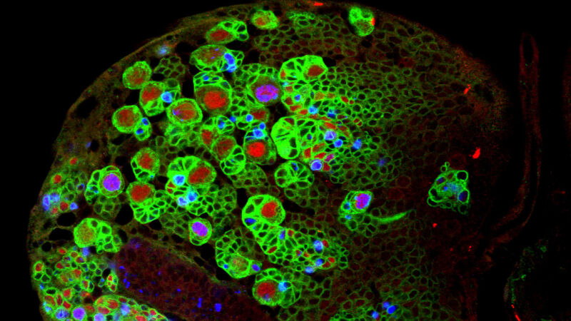 Fruit flies could help scientists stop the growth of brain tumours Fruit flies could help scientists stop the growth of brain tumours
