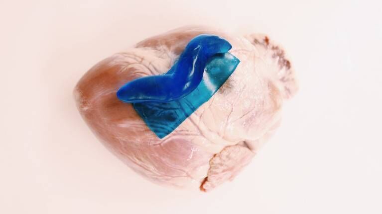 A sealant inspired by slug mucus successfully patched a hole in a beating pig’s heart. Jianya Li/Adam D Celiz/David J Mooney A sealant inspired by slug mucus successfully patched a hole in a beating pig’s heart. Jianya Li/Adam D Celiz/David J Mooney