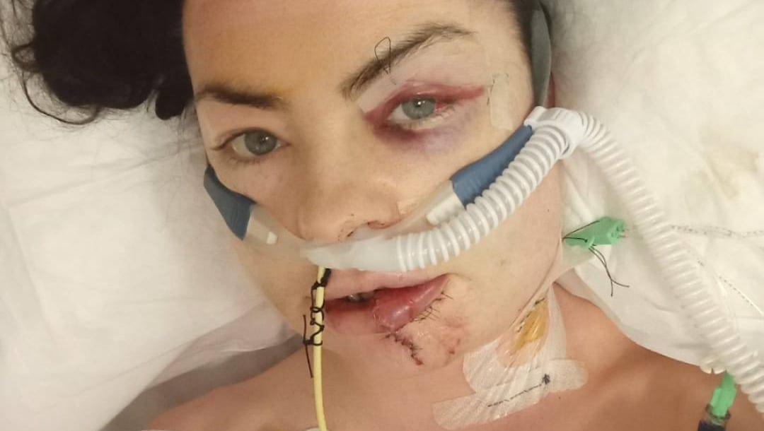 Road-crash survivor Róisín: It’s terrifying even to be a passenger now