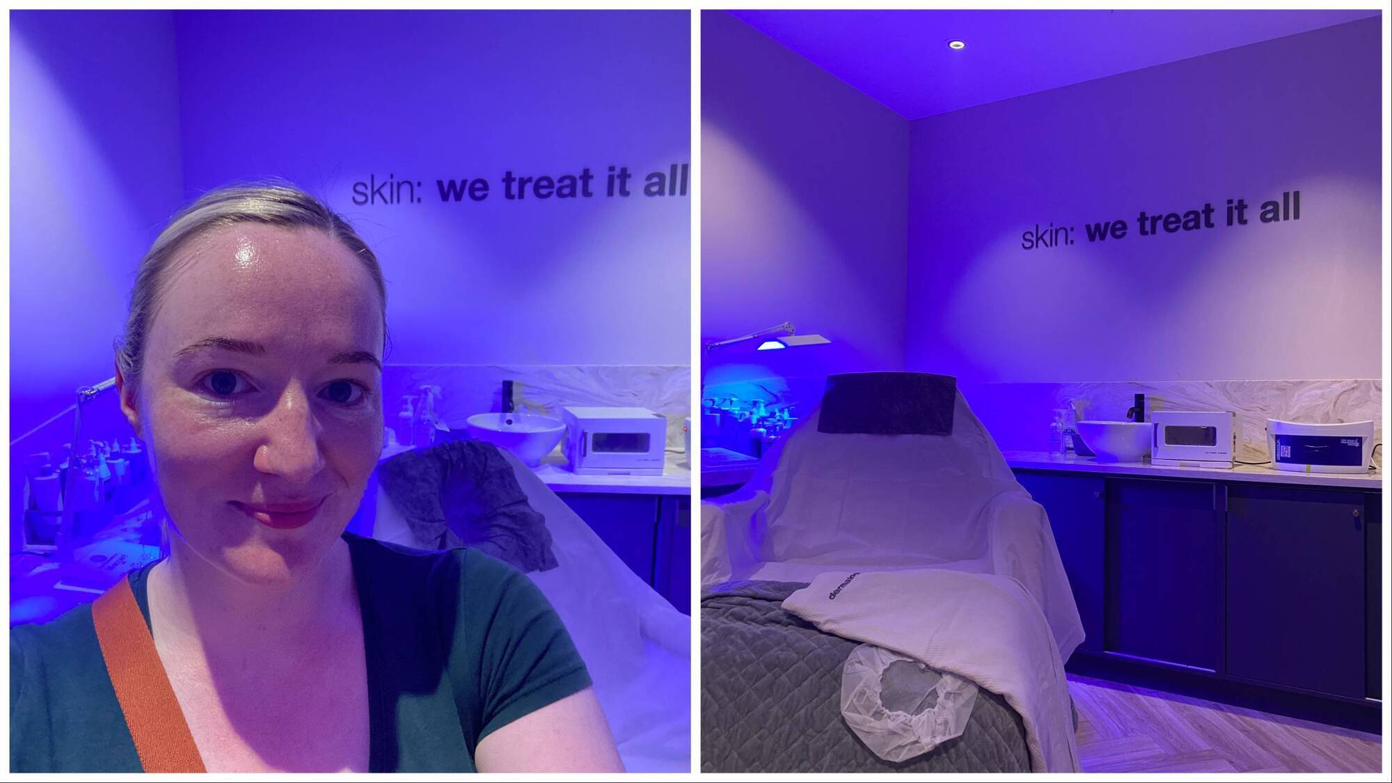 Tried and tested: What it’s like to get a LuminFusion facial at Mahon Point's treatment room
