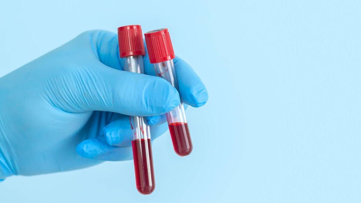 A new hope for early cancer detection — but is it reliable? - Vimarsana News