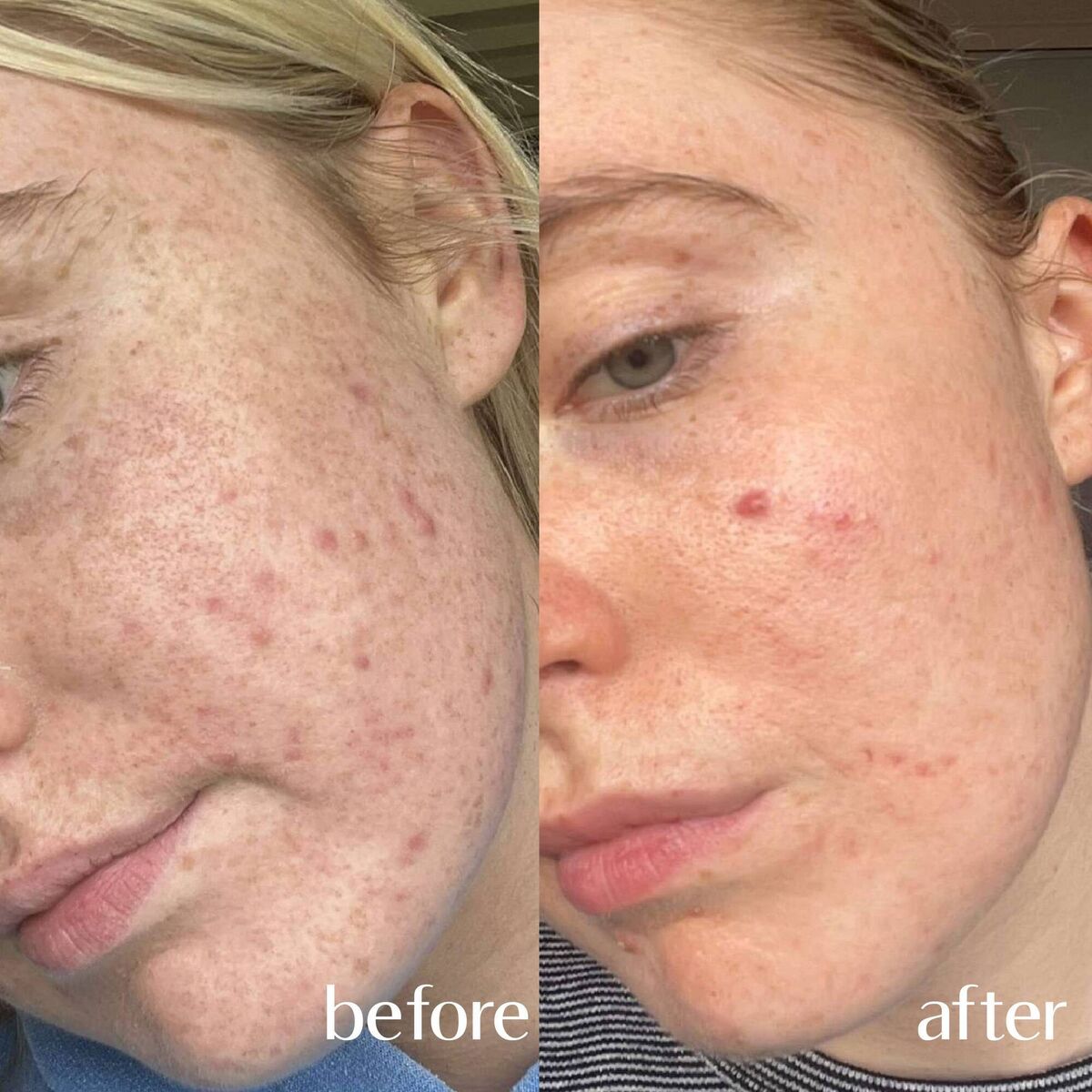 To find out how you can have fresher, younger, rejuvenated skin, book a free consultation with one of the expert specialists at Eden Medical Clinic.