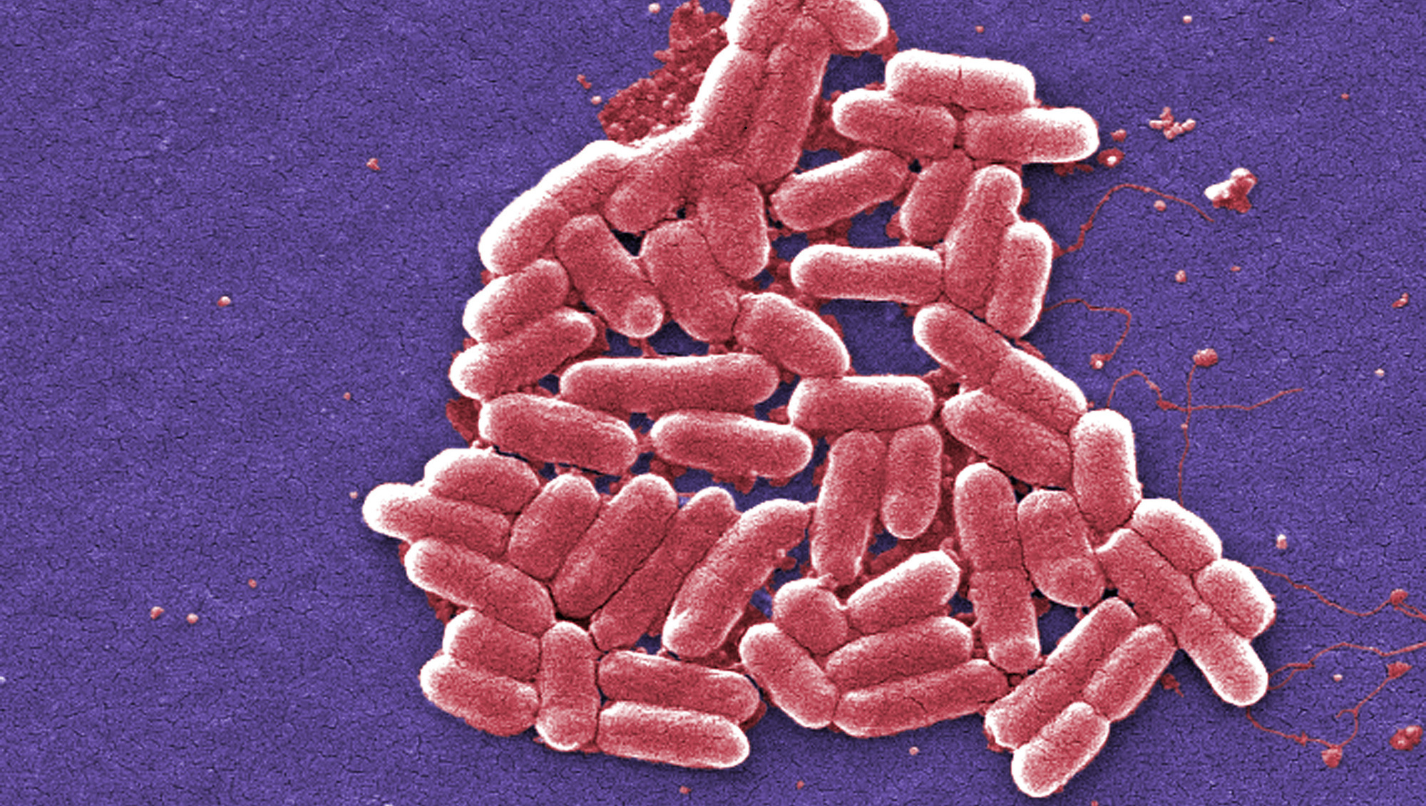 One person dies linked to E. coli outbreak in the UK ‘spread by lettuce’