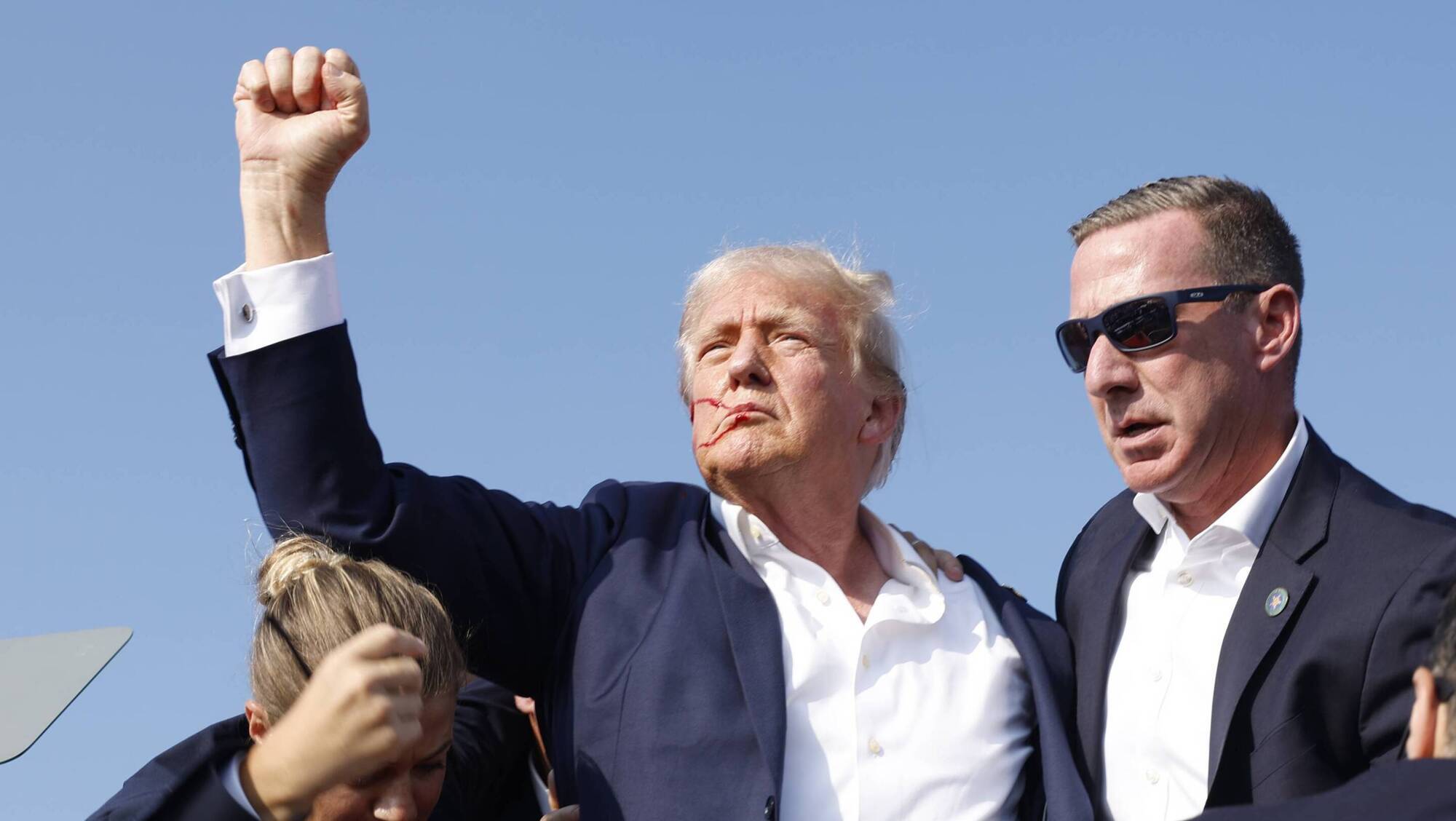 To speculate that the world might be better if Trump had not survived is to sink to his level