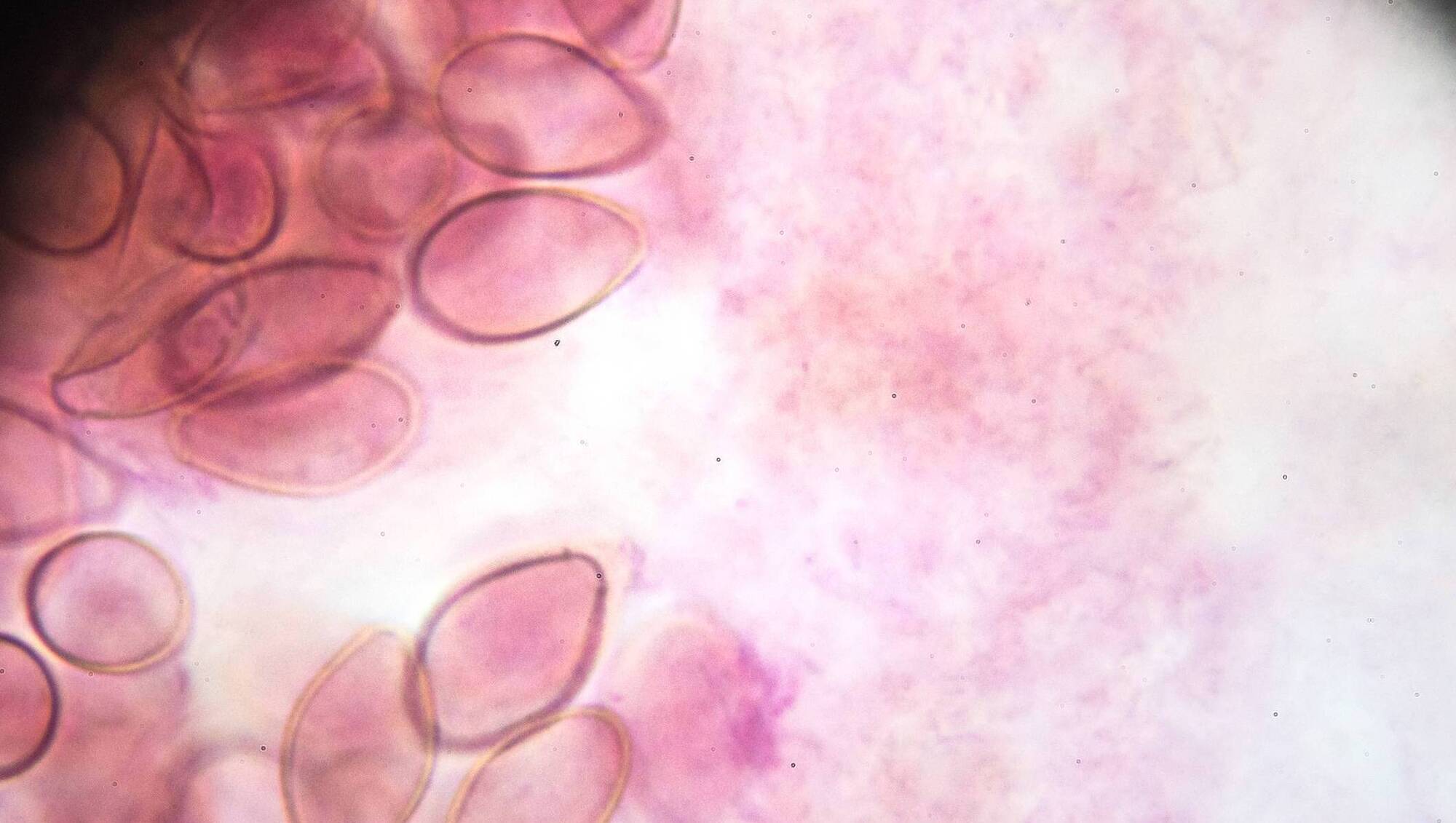 Are worms winning the 'Parasite Olympics' — The science behind the race to resistance