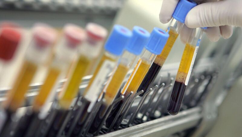 The Africa CDC previously said that mpox, also known as monkeypox, has been detected in 13 countries this year. Picture: Getty Image The Africa CDC previously said that mpox, also known as monkeypox, has been detected in 13 countries this year. Picture: Getty Image