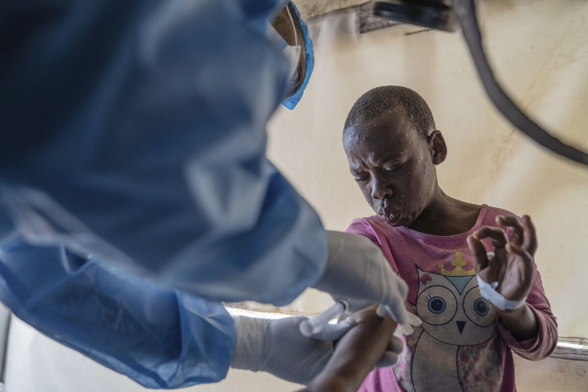 A health worker attends to a mpox patient, at a treatment centre in Munigi, eastern Congo. A health worker attends to a mpox patient, at a treatment centre in Munigi, eastern Congo.
