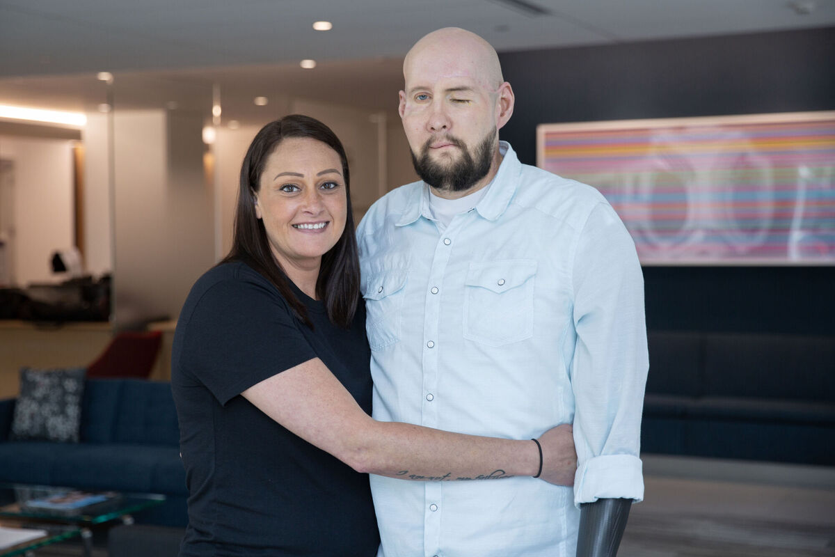 Aaron James with his wife Meagan in August 2024. In May 2023, he underwent 21 hours of surgery involving more than 140 healthcare professionals to replace his face — which included getting a new eye. Picture: Haley Riccardi/NYU Langone Health/PA Wire
