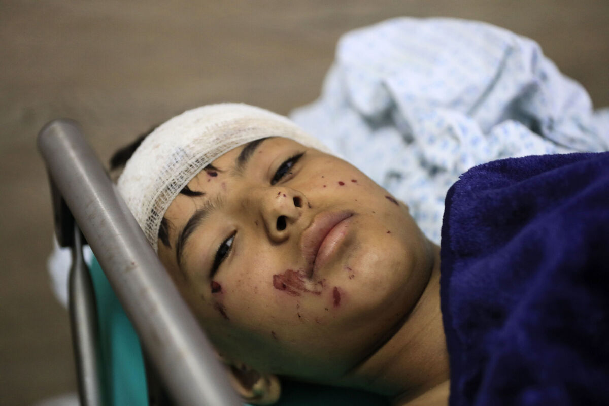 A wounded boy lies in a hospital bed in the southern village of Saksakieh, Lebanon, today. (AP Photo/Mohammed Zaatari)