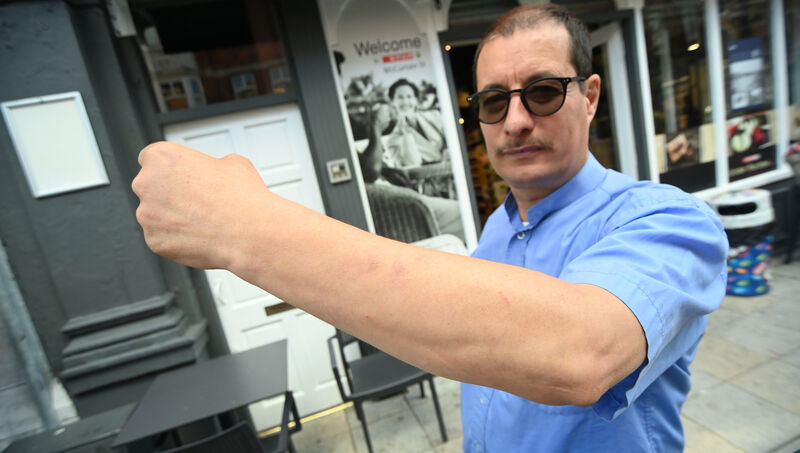 George Palcu, an employee at Spar on MacCurtain Street, shows scarring on his left forearm after a recent alleged assault by a customer. Picture: Larry Cummins George Palcu, an employee at Spar on MacCurtain Street, shows scarring on his left forearm after a recent alleged assault by a customer. Picture: Larry Cummins
