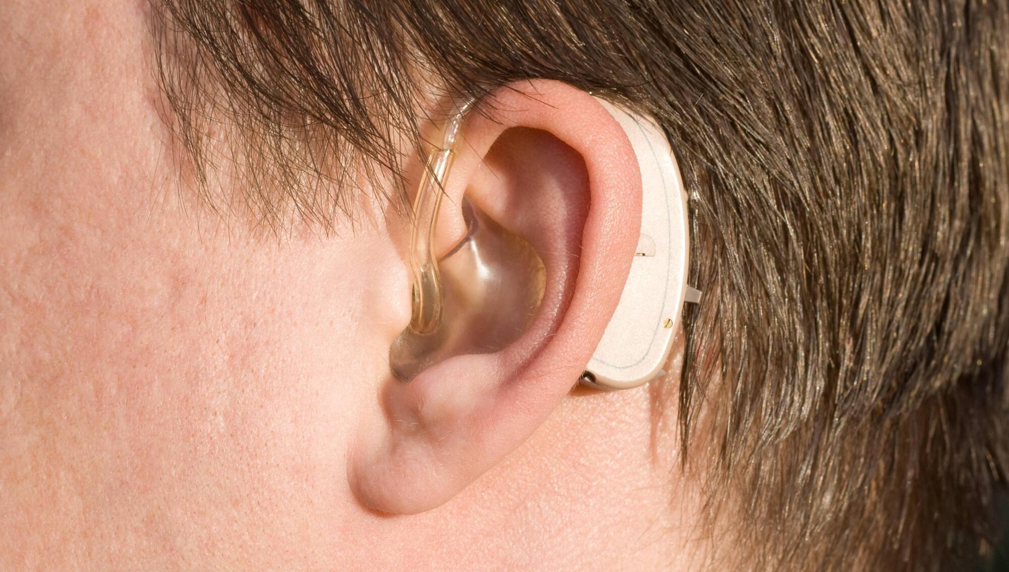 Worries of 'listening device' at Cork court after hearing aid picks up private talk between barristers