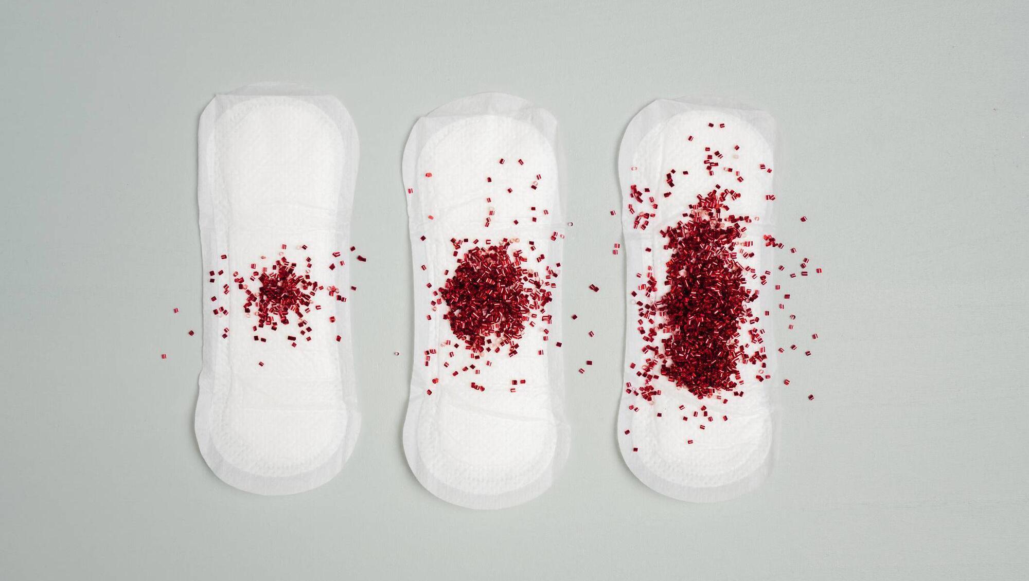 Natural Health: What can my sporty daughter do about her irregular periods?