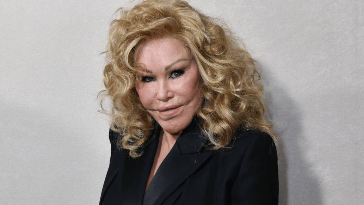 Jocelyne Wildenstein, socialite known for extreme cat-like plastic surgery, dies at 84