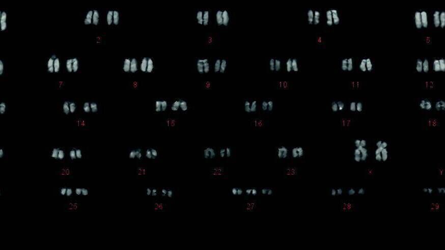  Karyotype testing of a heifer can confirm she has an extra copy of chromosome 27. Picture: Teasgasc