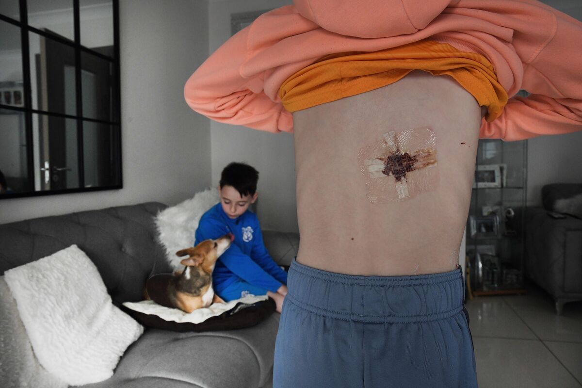  Mason Geraghty, 11, shows the wound he received after he was stabbed by another 11-year-old schoolboy at St Finian's National School on March 4. Also pictured is his brother Carter, 10. Picture: Moya Nolan
