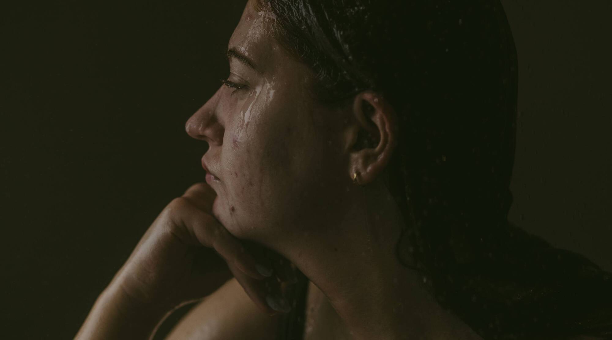 Dermorexia: ‘My pursuit of clear skin has cost me time, money and pain, but how far is too far?’