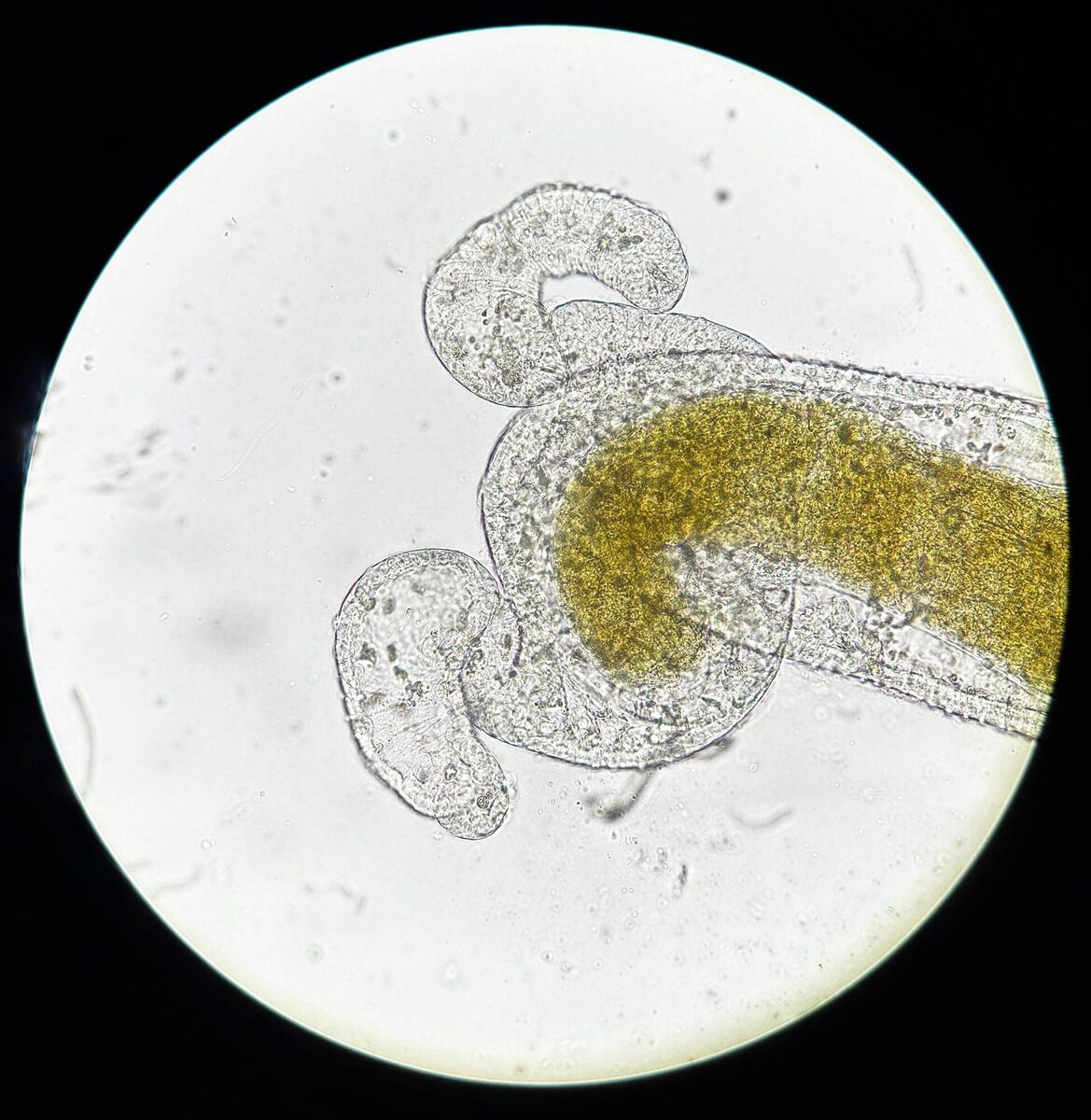 Parasite spore clusters (Ordospora colligata) seen as black dots within the gut of the host, Daphnia magna Parasite spore clusters (Ordospora colligata) seen as black dots within the gut of the host, Daphnia magna