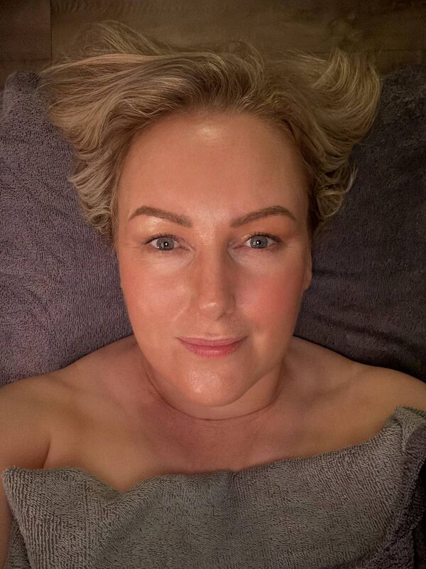 Sally Foran, before her facial Sally Foran, before her facial