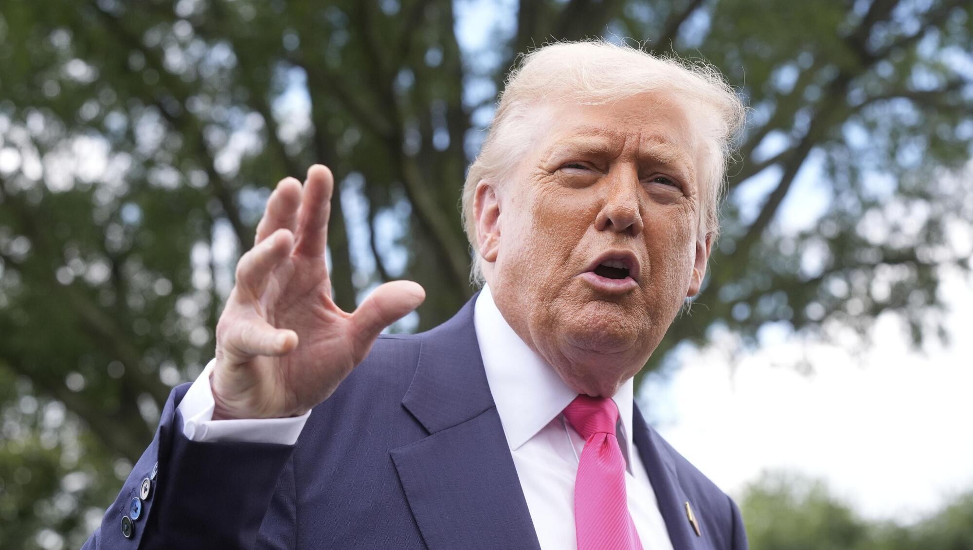 Trump diagnosed with vein condition causing leg swelling, White House says