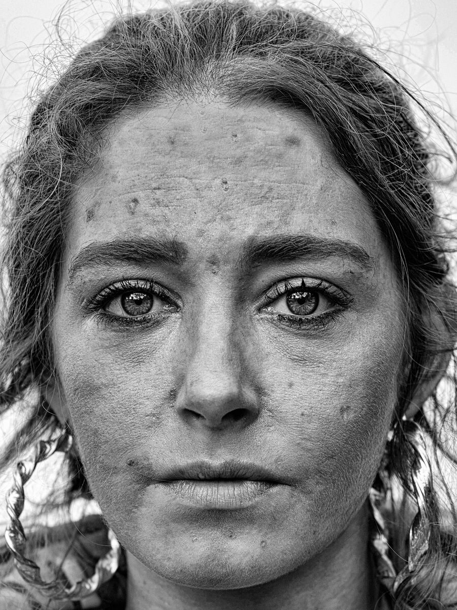 A photo of Antoinette Foley from James Mahon's book 'The Hawk Against The Dove: Addiction in Small-Town Ireland'. Picture: James Mahon/PA Wire A photo of Antoinette Foley from James Mahon's book 'The Hawk Against The Dove: Addiction in Small-Town Ireland'. Picture: James Mahon/PA Wire