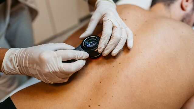 <p>All of us acquire moles, but detecting the benign ones from cancerous moles is something of a challenge.  Moles which are either bleeding and painful, looking more lumpy than possible, or seemingly irregular or changing in shape, are cause for concern.</p>