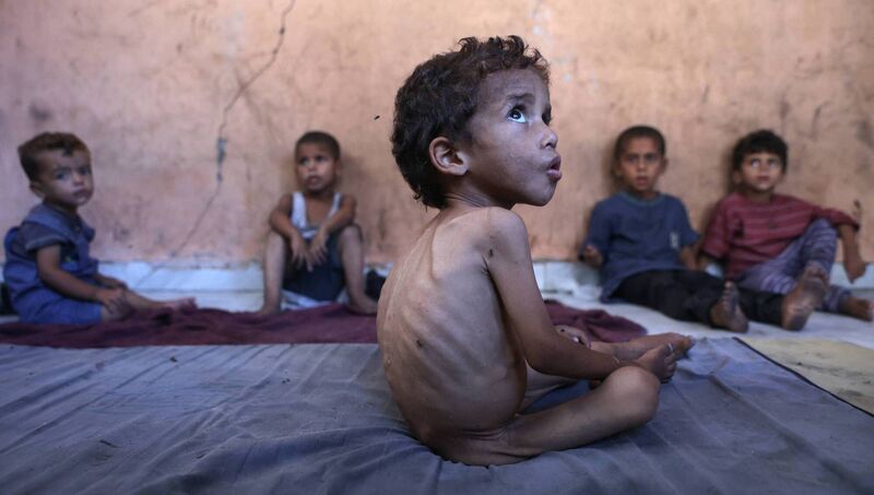 Yazan, a malnourished two-year-old boy, with his brothers at their family's damaged home in the Al-Shati camp, west of Gaza City in Palestine. Picture: Omar Al-Qattaa/AFP/Getty