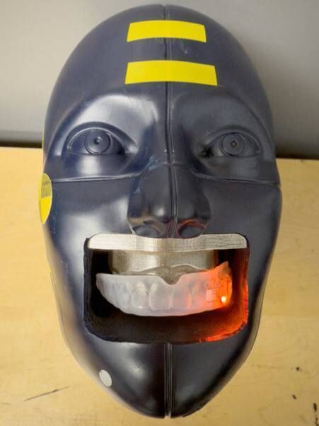 The LED mouthguard that will be introduced at the Women’s Rugby World Cup. Pic: World Rugby