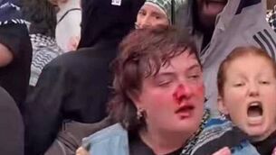 <p>Kitty O'Brien was physically assaulted at a protest in Berlin. </p> <p>Kitty O'Brien was physically assaulted at a protest in Berlin. </p>