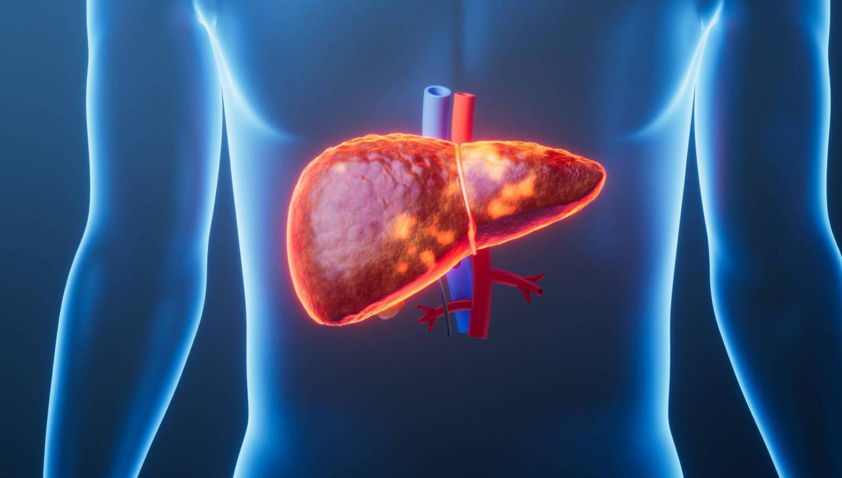 Seven things you can do to keep your liver healthy and avoid disease