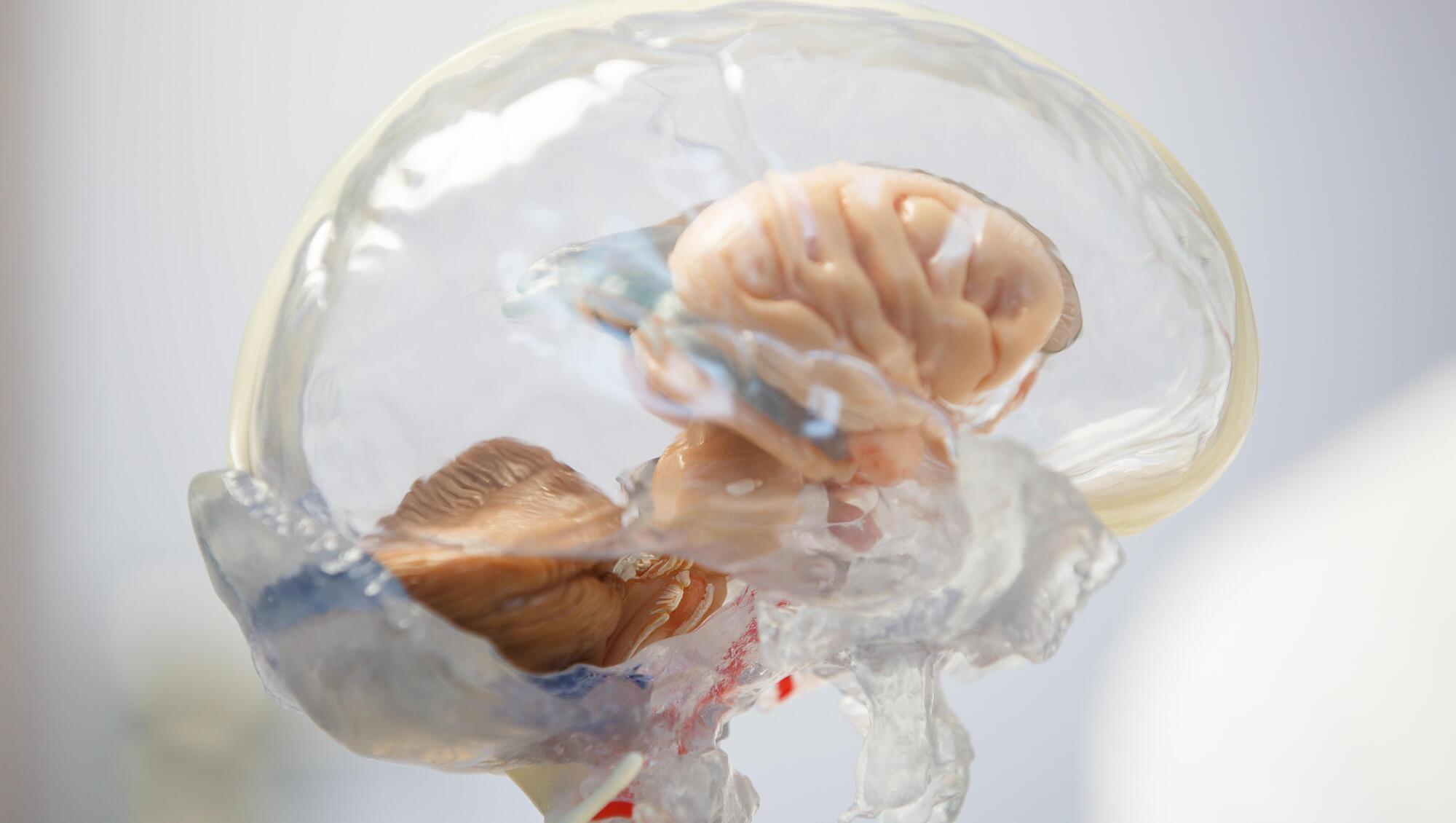 Two new subtypes of MS found in 'exciting' breakthrough