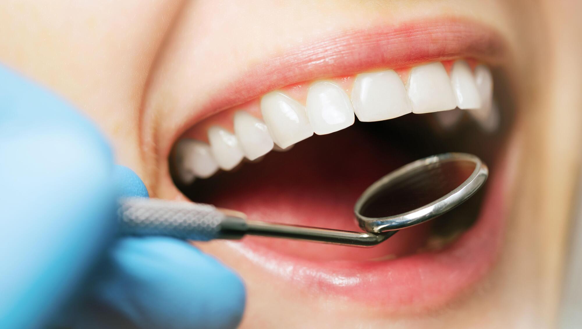 Department defends commitment to oral health policy despite no date for implementation plan