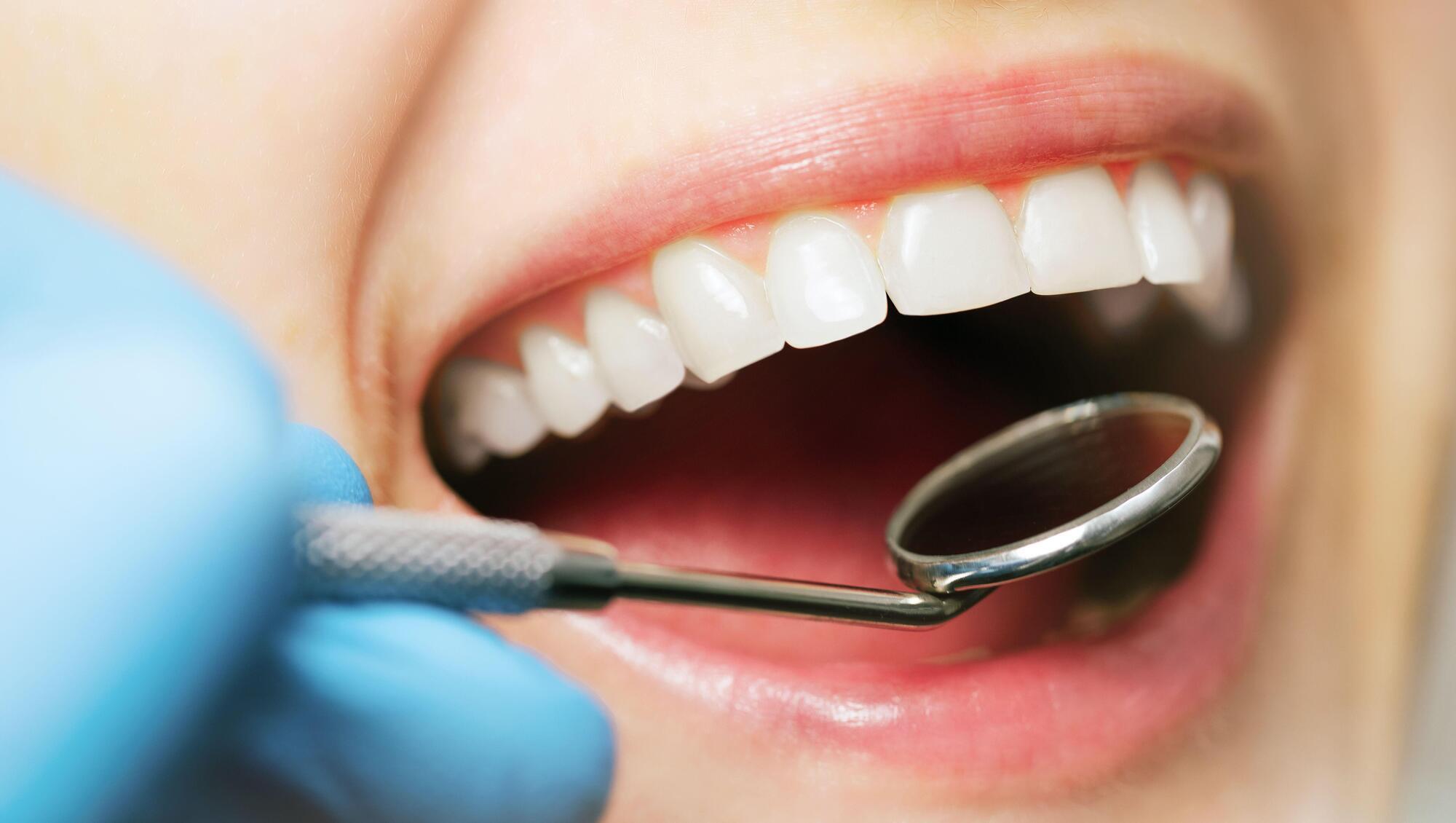 Fixing Ireland's dental crisis will take 10 years given scale of problem, Dáil committee told