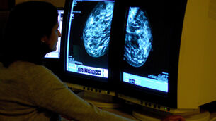 <p>Irish Cancer Society director of advocacy Steve Dempsey pointed to reports last year that BreastCheck had missed its target of 195,000 screenings in 2024 by just under 30%. Stock picture</p>