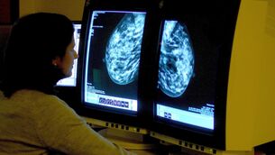 <p dir="ltr">AI is able to improve breast cancer outcomes for patients as the technology can find more early signs of cancer faster than “imperfect” traditional methods.</p>